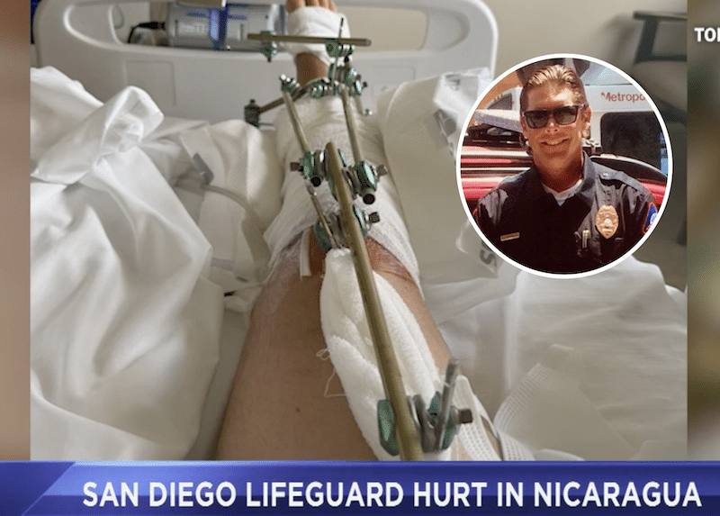 San Diego lifeguard hit by boat while surfing in “freak accident”